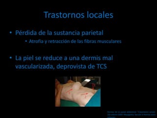Trastornos locales
• Pérdida de la sustancia parietal
• Atrofia y retracción de las fibras musculares
• La piel se reduce a una dermis mal
vascularizada, deprovista de TCS
Hernias de la pared abdominal. Tratamiento actual.
2da edición 2009. Mayagoitia. Sección V Hernias poco
comunes
 