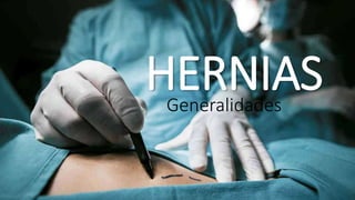 Generalidades
HERNIAS
 