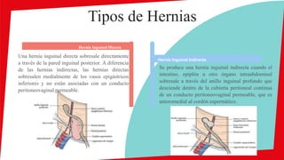 Hernias presentación.pptx