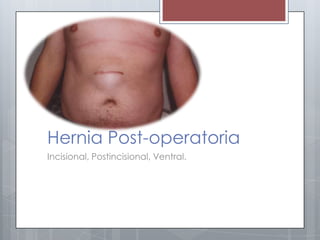 Hernias umbilicales y post | PPTX