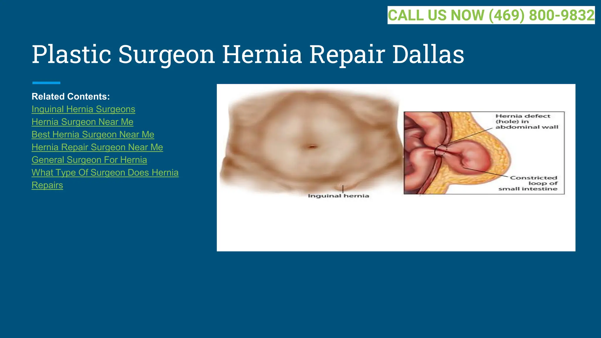 Plastic Surgeon Hernia Repair Dallas
Related Contents:
Inguinal Hernia Surgeons
Hernia Surgeon Near Me
Best Hernia Surgeon Near Me
Hernia Repair Surgeon Near Me
General Surgeon For Hernia
What Type Of Surgeon Does Hernia
Repairs
CALL US NOW (469) 800-9832
 
