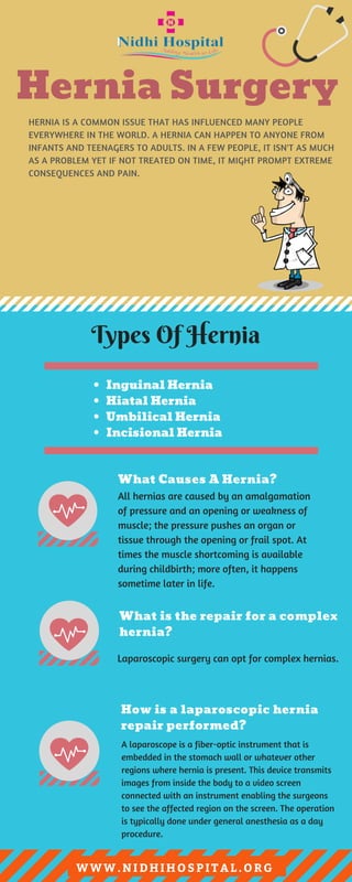 Hernia surgery in india | PDF