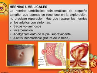 HERNIAS DE LA PARED ABDOMINAL | PPTX