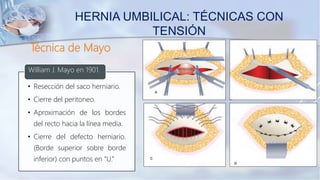 Técnica de Mayo
• Resección del saco herniario.
• Cierre del peritoneo.
• Aproximación de los bordes
del recto hacia la línea media.
• Cierre del defecto herniario.
(Borde superior sobre borde
inferior) con puntos en “U.”
William J. Mayo en 1901.
HERNIA UMBILICAL: TÉCNICAS CON
TENSIÓN
 