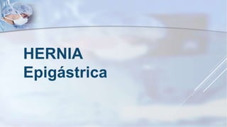 HERNIA
Epigástrica
 