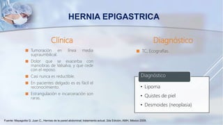 Clínica
 Tumoración en línea media
supraumbilical.
 Dolor que se exacerba con
maniobras de Valsalva, y que cede
con el reposo.
 Casi nunca es reductible.
 En pacientes delgado es es fácil el
reconocimiento.
 Estrangulación e incarceración son
raras.
Diagnóstico
 TC, Ecografías.
• Lipoma
• Quistes de piel
• Desmoides (neoplasia)
Diagnóstico
HERNIA EPIGASTRICA
Fuente: Mayagoitia G. Juan C., Hernias de la pared abdominal; tratamiento actual, 2da Edición, AMH, México 2009,
 