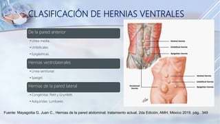 Fuente: Mayagoitia G. Juan C., Hernias de la pared abdominal; tratamiento actual, 2da Edición, AMH, México 2019, pág.. 349
CLASIFICACIÓN DE HERNIAS VENTRALES
De la pared anterior
• Línea media.
• Umbilicales.
• Epigástricas.
Hernias ventrolaterales
• Línea semilunar.
• Speigel.
Hernias de la pared lateral
• Congénitas: Petit y Grynfeltt.
• Adquiridas: Lumbares.
 