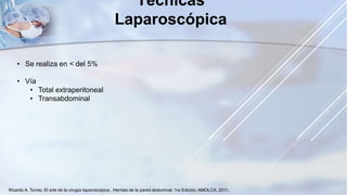 Técnicas
Laparoscópica
• Se realiza en < del 5%
• Vía
• Total extraperitoneal
• Transabdominal
Ricardo A. Torres. El arte de la cirugía laparoscópica , Hernias de la pared abdominal; 1ra Edición, AMOLCA, 2011,
 