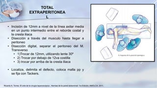 • Incisión de 12mm a nivel de la línea axilar media
en un punto intermedio entre el reborde costal y
la cresta iliaca
• Disección a través del musculo hasta llegar a
peritoneo
• Disección digital, separar el peritoneo del M.
Transverso
• 1)Trocar de 12mm, utilizando lente 30º
• 2) Trocar por debajo de 12va costilla
• 3) trocar por arriba de la cresta iliaca
• Localiza, delimita el defecto, coloca malla pp y
se fija con Tackers.
TOTAL
EXTRAPERITONEA
L
Ricardo A. Torres. El arte de la cirugía laparoscópica , Hernias de la pared abdominal; 1ra Edición, AMOLCA, 2011,
 