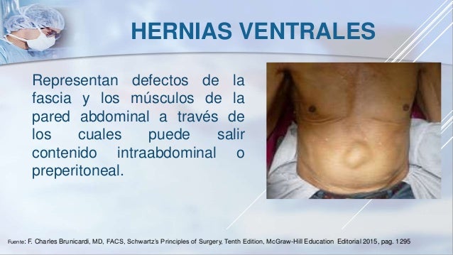 Hernia Umbilicalis Ohne Einklemmung Und Ohne Gangrän www.slideshare.net