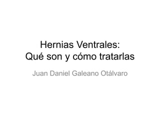 Hernias Ventrales:
Qué son y cómo tratarlas
Juan Daniel Galeano Otálvaro
 
