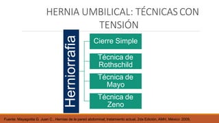 HERNIA UMBILICAL: TÉCNICAS CON
TENSIÓN
Herniorrafia
Fuente: Mayagoitia G. Juan C., Hernias de la pared abdominal; tratamiento actual, 2da Edición, AMH, México 2009,
Cierre Simple
Técnica de
Rothschild
Técnica de
Mayo
Técnica de
Zeno
 