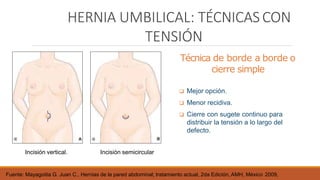 HERNIA UMBILICAL: TÉCNICAS CON
TENSIÓN
Técnica de borde a borde o
cierre simple
 Mejor opción.
 Menor recidiva.
 Cierre con sugete continuo para
distribuir la tensión a lo largo del
defecto.
Incisión vertical.
Fuente: Mayagoitia G. Juan C., Hernias de la pared abdominal; tratamiento actual, 2da Edición, AMH, México 2009,
Incisión semicircular
 