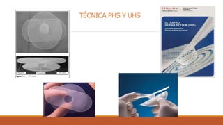TÉCNICA PHS Y UHS
 