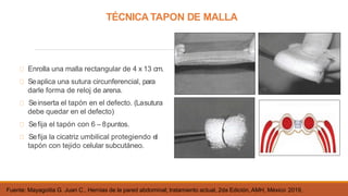 Enrolla una malla rectangular de 4 x 13 cm.
Seaplica una sutura circunferencial, para
darle forma de reloj de arena.
Seinserta el tapón en el defecto. (Lasutura
debe quedar en el defecto)
Sefija el tapón con 6 – 8puntos.
Sefija la cicatriz umbilical protegiendo el
tapón con tejido celular subcutáneo.
TÉCNICA TAPON DE MALLA
Fuente: Mayagoitia G. Juan C., Hernias de la pared abdominal; tratamiento actual, 2da Edición, AMH, México 2019,
 