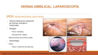 HERNIA UMBILICAL: LAPAROSCOPÍA
IPOM (INTRA PERITONEAL ONLAY MESH)
Técnica habitual de reparación
de hernias ventrales e
incisionales.
Ventajas:
Menor recidivas.
Recuperación rápida.
Reforzamiento de la línea media.
Desventajas:
Costo.
Mayor incidencia de seromas.
Ricardo A. Torres. El arte de la cirugía laparoscópica , Hernias de la pared abdominal; 1ra Edición, AMOLCA,2011,
 