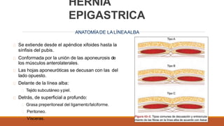 HERNIA
EPIGASTRICA
ANATOMÍADE LA LÍNEAALBA
Se extiende desde el apéndice xifoides hasta la
sínfisis del pubis.
Conformada por la unión de las aponeurosis de
los músculos anterolaterales.
Las hojas aponeuróticas se decusan con las del
lado opuesto.
Delante de la línea alba:
Tejido subcutáneo ypiel.
Detrás, de superficial a profundo:
Grasa preperitoneal del ligamentofalciforme.
Peritoneo.
Vísceras.
 