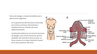 Hernia de Spiegel: a través del defecto de la
aponeurosis spigeliana
- Es la aponeurosis del transverso encerrada
por la línea semilunar lateralmente y
medialmente por el borde del recto
abdominal lateral.
- Localización habitual es el cinturón herniario
de Spiegel, zona ancha transversa de 6cm
alrededor del nivel de la línea arcuata. La
línea arcuata es la mayor extensión caudal
de la vaina posterior del recto
 