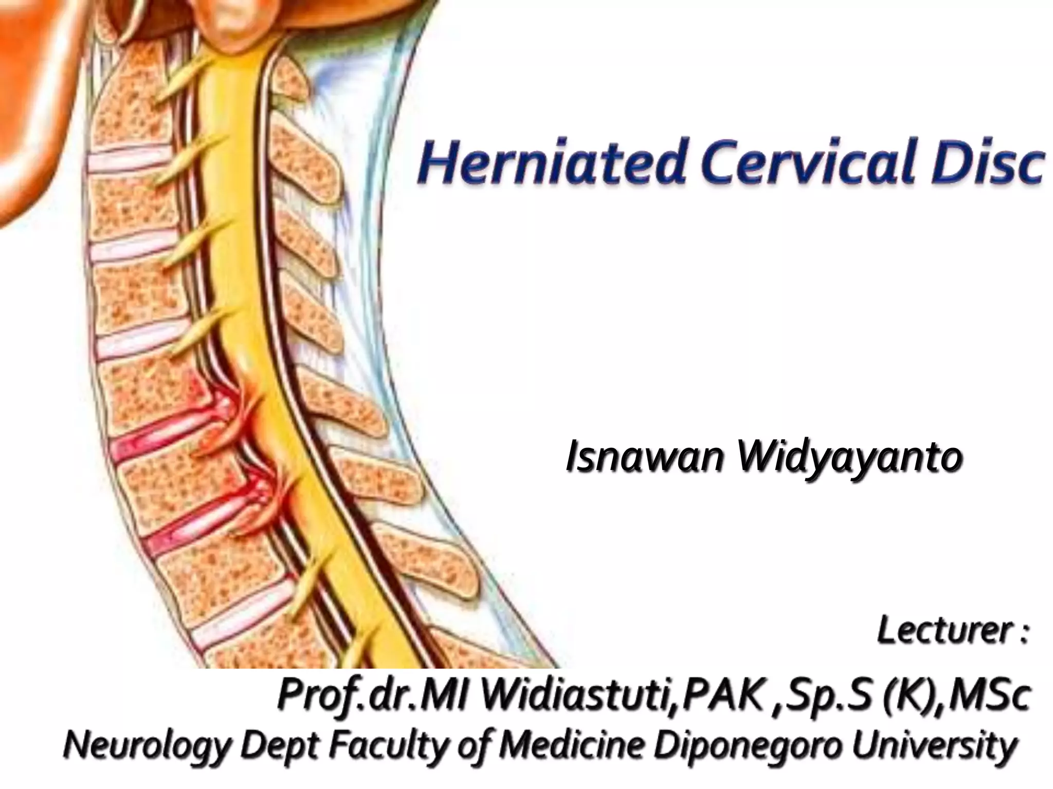 Q A CERVICAL HERNIATED DISK visual data 8