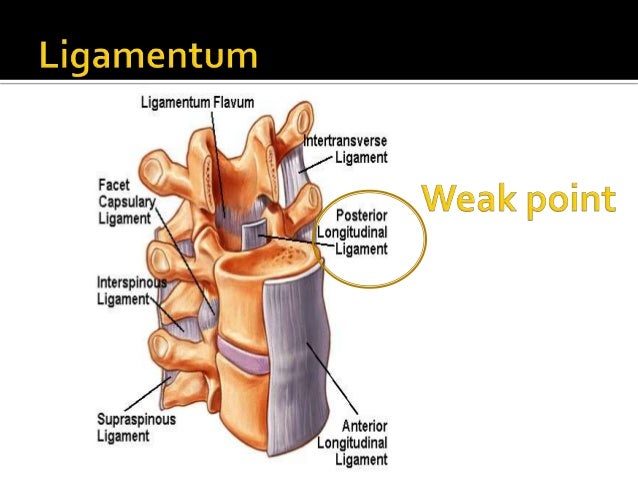 cervical disc herniation exercises pdf