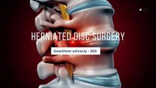 HERNIATED DISC SURGERY
Gowtham selvaraj - 303
 