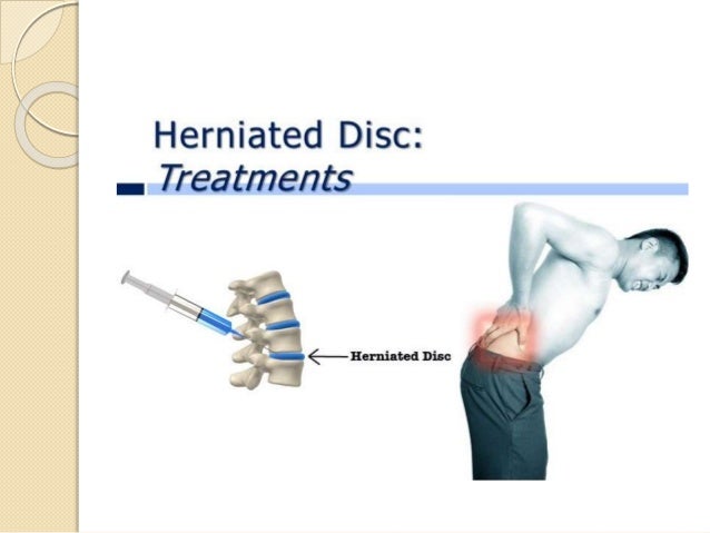 Best Natural Treatment For Herniated Disc Best Natural Treatment For Herniated Disc