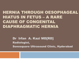 HERNIA THROUGH OESOPHAGEAL
HIATUS IN FETUS – A RARE
CAUSE OF CONGENITAL
DIAPHRAGMATIC HERNIA
Dr Irfan A. Kazi MD[RD]
Radiologist,
Sonosquare Ultrasound Clinic, Hyderabad
 