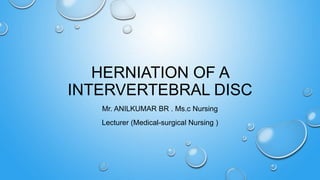 HERNIATION OF A
INTERVERTEBRAL DISC
Mr. ANILKUMAR BR . Ms.c Nursing
Lecturer (Medical-surgical Nursing )
 