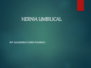 HERNIA UMBILICAL
INT ALEJANDRA FLORES PUSARICO
 