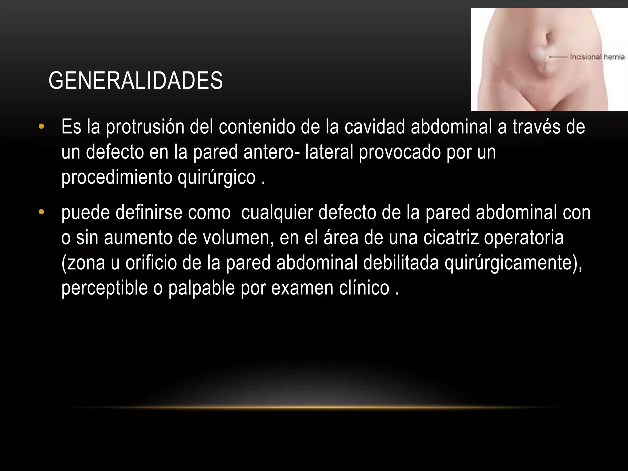Hernia ventral post incisional | PPT