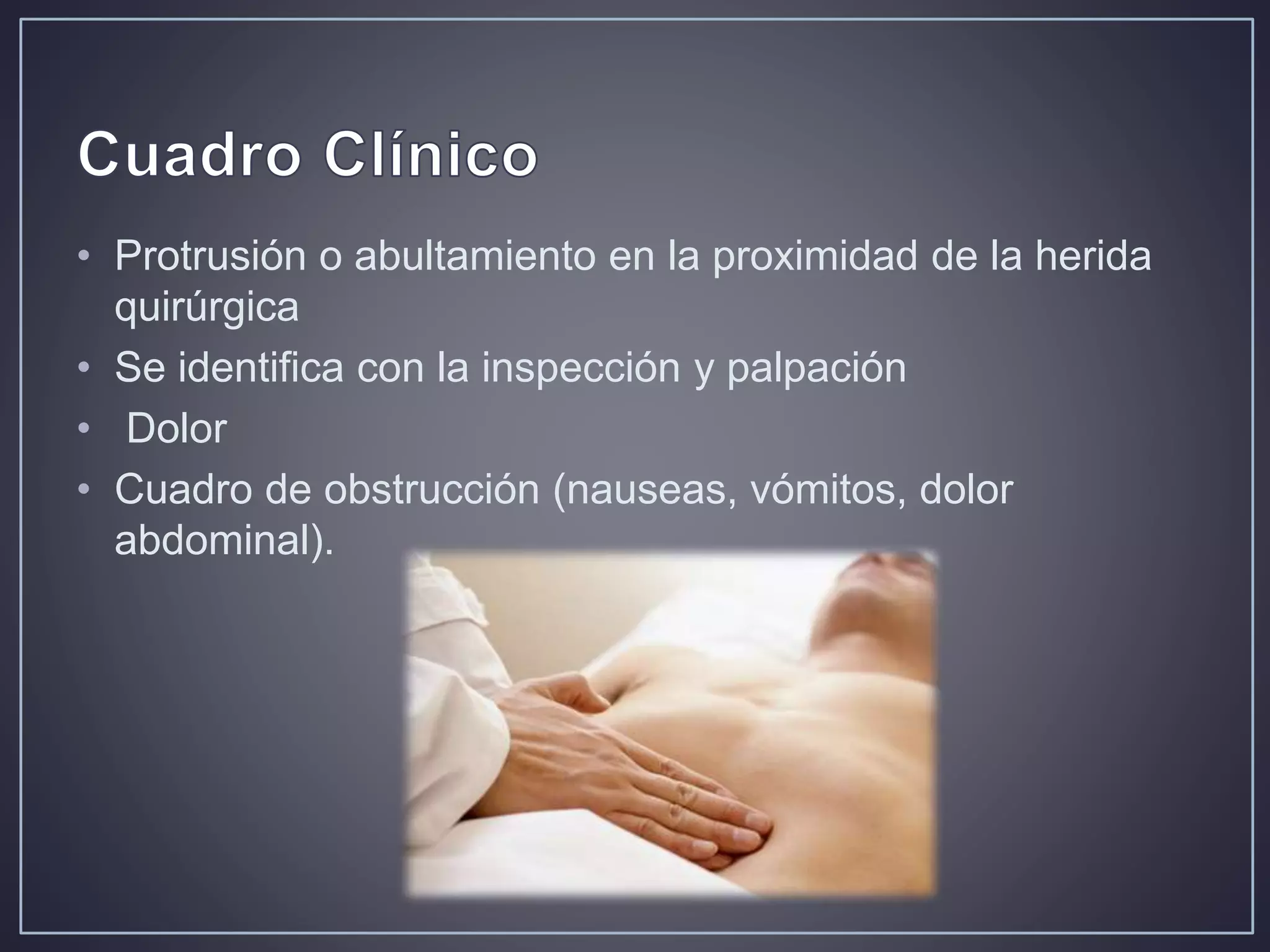 Hernia ventral post incisional | PPTX | Surgery | Medical Health