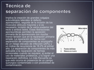 Hernia ventral post incisional | PPTX
