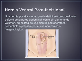 Hernia ventral post incisional | PPTX