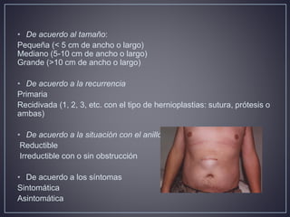 Hernia ventral post incisional | PPTX