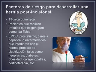 Hernia ventral post incisional | PPTX