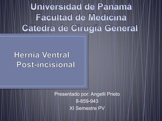 Presentado por: Angelli Prieto
8-859-943
XI Semestre PV
 