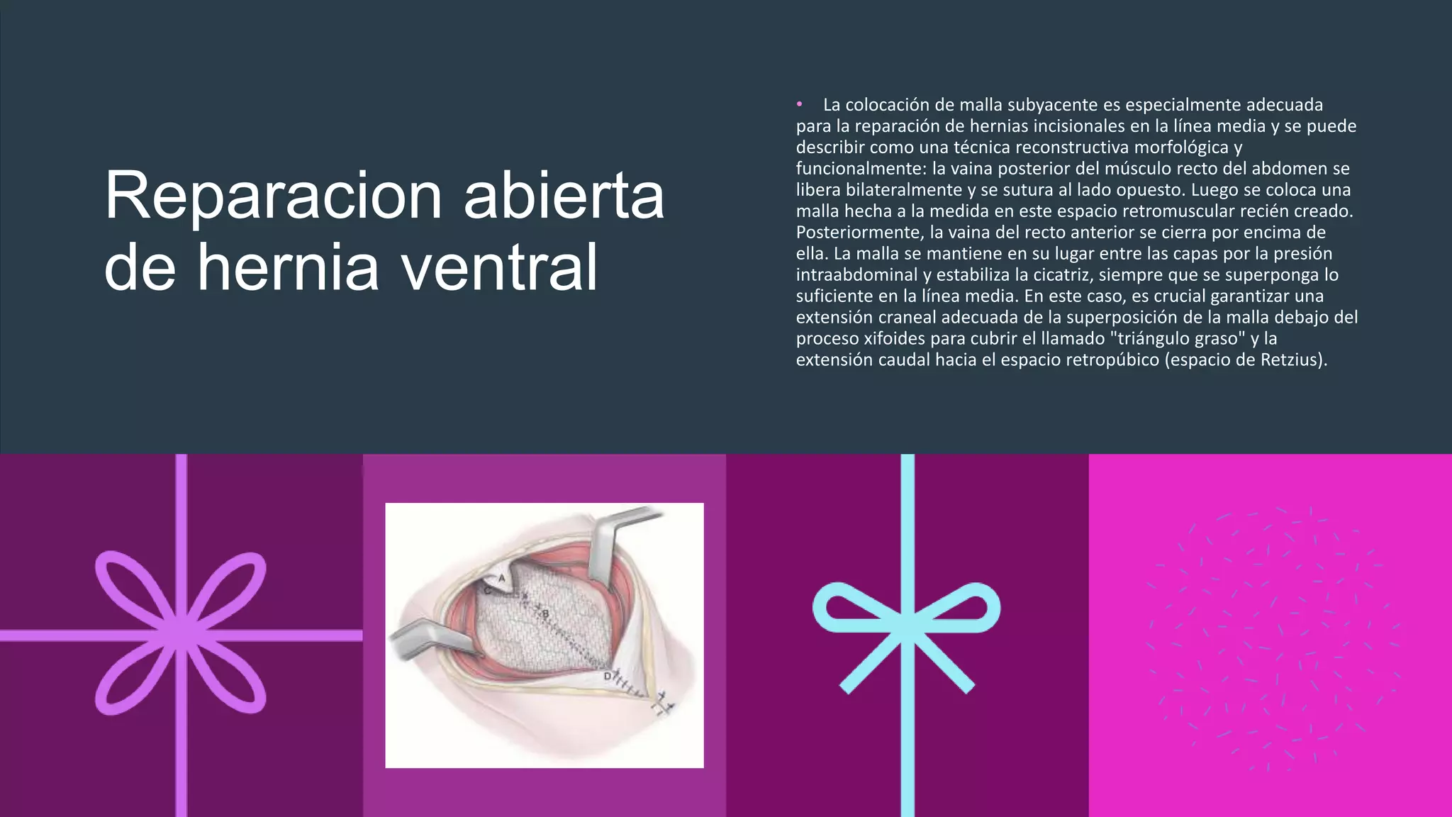 Hernia ventral postincisional.pptx | Descarga Gratuita