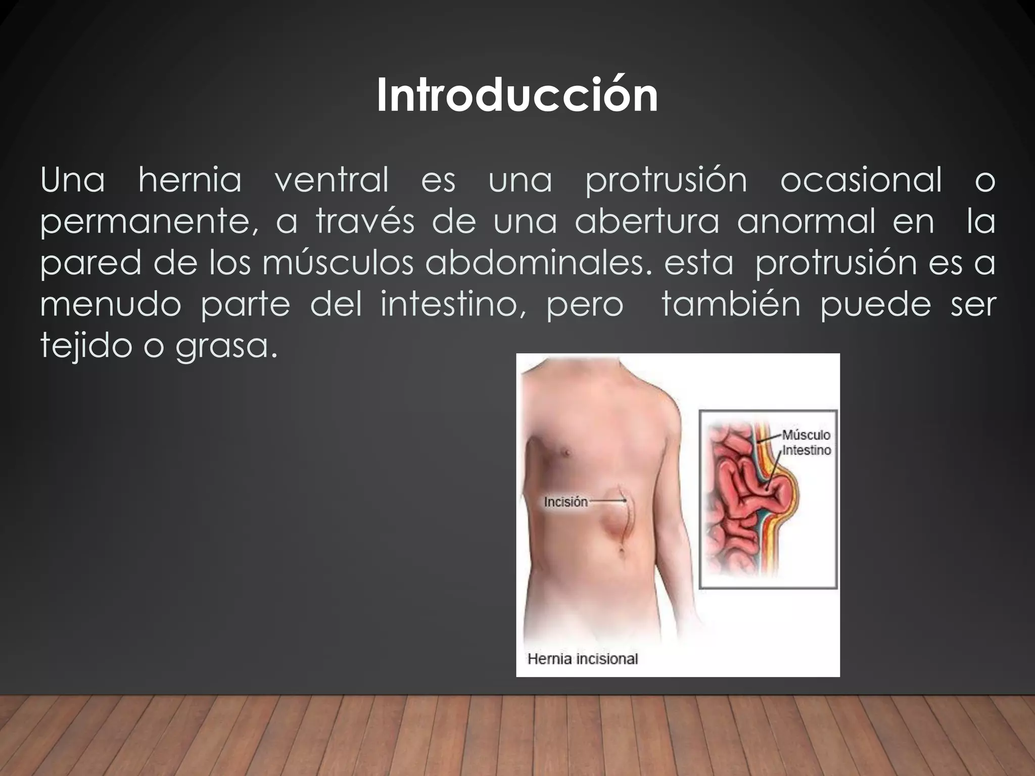 Hernia ventral post incisional Ricardo Young pdf | PPT