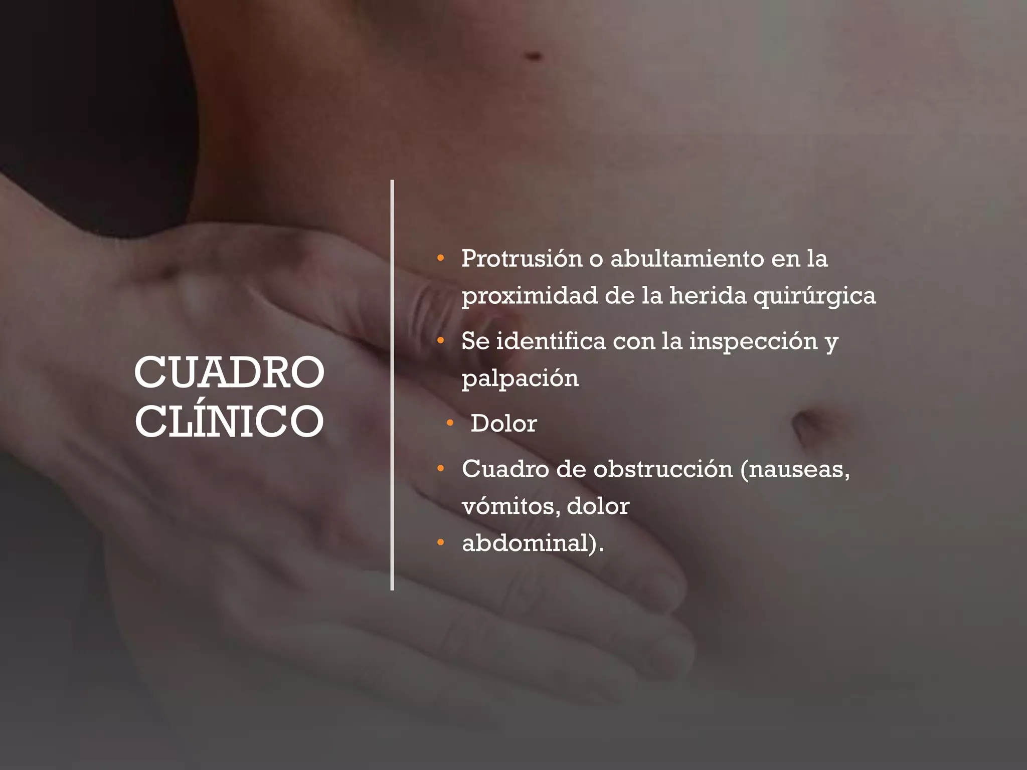 Hernia ventral post incisional Ricardo Young pdf | PPT