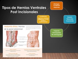 Hernia ventral post incisional Ricardo Young pdf | PDF