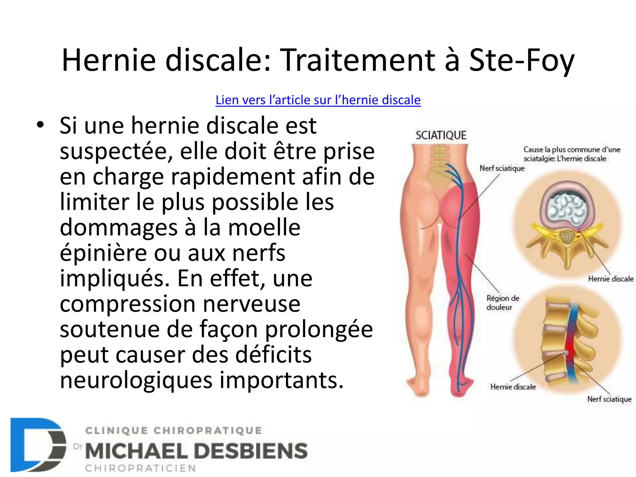 Hernie discale Description, causes, symptômes et traitement