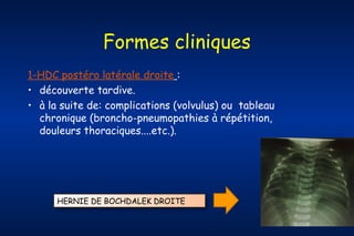 Formes cliniques
1-HDC postéro latérale droite :
• découverte tardive.
• à la suite de: complications (volvulus) ou tableau
chronique (broncho-pneumopathies à répétition,
douleurs thoraciques....etc.).

HERNIE DE BOCHDALEK DROITE

 