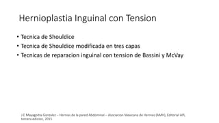 Hernioplastia Inguinal con Tension
• Tecnica de Shouldice
• Tecnica de Shouldice modificada en tres capas
• Tecnicas de reparacion inguinal con tension de Bassini y McVay
J.C Mayagoitia Gonzalez – Hernias de la pared Abdominal – Asociacion Mexicana de Hernias (AMH), Editorial Alfi,
tercera edicion, 2015
 