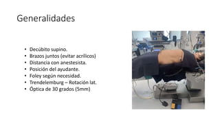 Generalidades
• Decúbito supino.
• Brazos juntos (evitar acrílicos)
• Distancia con anestesista.
• Posición del ayudante.
• Foley según necesidad.
• Trendelemburg – Rotación lat.
• Óptica de 30 grados (5mm)
 