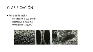 CLASIFICACIÓN
• Peso de la Malla
• Pesadas (46 a 100 g/m2)
• Ligeras (29 a 45 g/m2)
• Ultraligeras (28 g/m2 o menor)
 