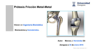 Marcos Javier Hernández Gil | 1
Prótesis Fricción Metal-Metal
Biomecánica y biomateriales.
Autor: Marcos J. Hernández Gil
Zaragoza a 30 de enero 2018
Máster en Ingeniería Biomédica
 