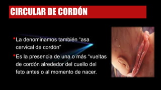 CIRCULAR DE CORDÓN
•La denominamos también “asa
cervical de cordón”
•Es la presencia de una o más “vueltas
de cordón alrededor del cuello del
feto antes o al momento de nacer.
 