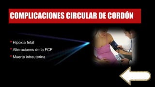 COMPLICACIONES CIRCULAR DE CORDÓN
•Hipoxia fetal
•Alteraciones de la FCF
•Muerte intrauterina
 