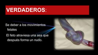 VERDADEROS:
Se deber a los movimientos
fetales
El feto atraviesa una asa que
después forma un nudo.
 