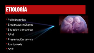 ETIOLOGÍA
•Polihidramnios
•Embarazos múltiples
•Situación transversa
•RPM
•Presentación pelvica
•Amniorrexis
•DCP
 